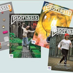 Gratis Psoriasis Magazine